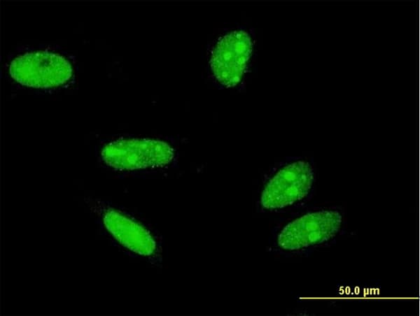 H2AFX / H2AX Antibody (clone 3F4)