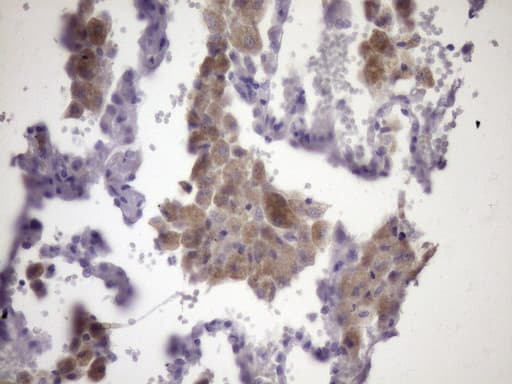 KIAA1524 / p90 Autoantigen Antibody (aa635-905, clone OTI9E6)