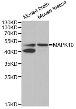 Polyclonal Rabbit anti-Human MAPK10 / JNK3 Antibody (IHC, WB)