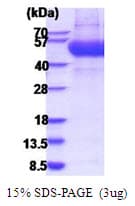 Human IL13RA1 / IL13R Alpha 1 Protein (Recombinant His)