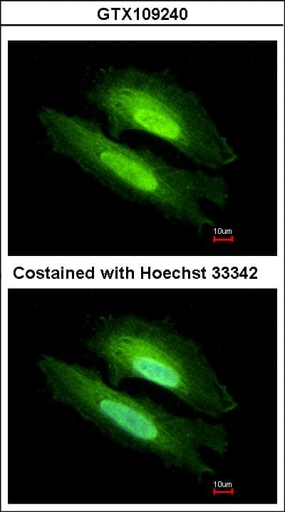 Polyclonal Rabbit anti-Human PDE6D / PDE6 Delta Antibody (aa1-150, IHC, WB)