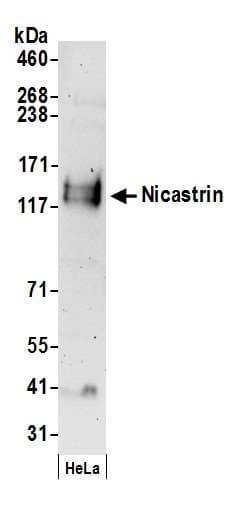 NCSTN / Nicastrin Antibody (aa659-709)