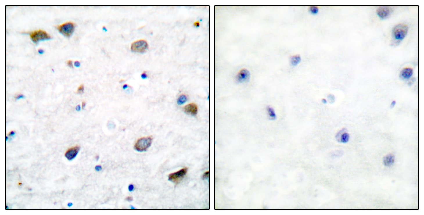 GABRB1 Antibody (aa401-450)