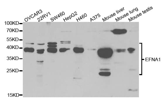 EFNA1 / Ephrin A1 Antibody
