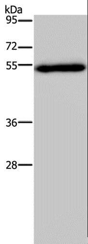 Polyclonal Rabbit anti-Human FOXC2 Antibody (WB)