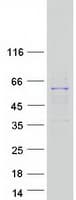 Human RRP8 Protein (Recombinant Myc-DDK (Flag))
