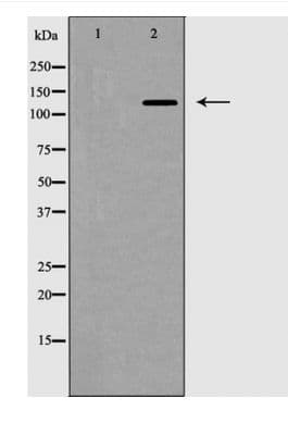 Polyclonal Rabbit anti-Human ZEB2 / SIP-1 Antibody (IHC, WB)