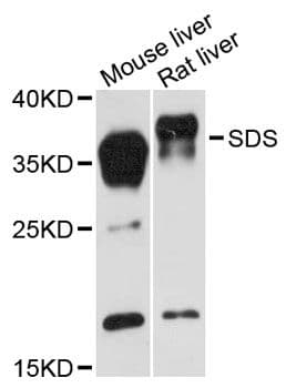 Polyclonal Rabbit anti-Human SDS Antibody (WB)