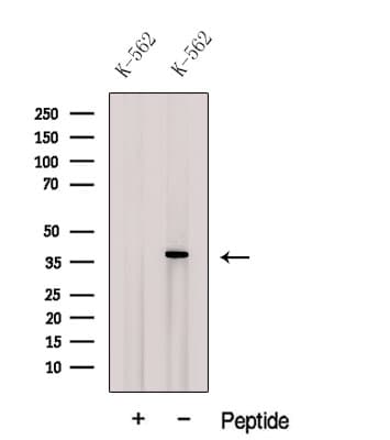 CPOX Antibody