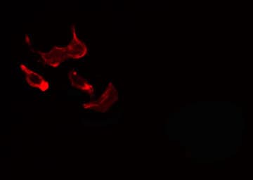 LAMC1 / Laminin Gamma 1 Antibody