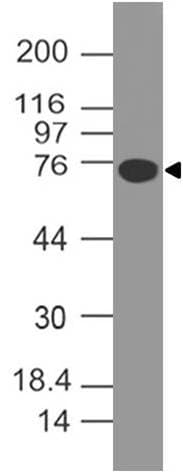 VTCN1 / B7-H4 Antibody