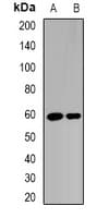 Polyclonal Rabbit anti-Human RAG2 / RAG-2 Antibody (IF, WB)