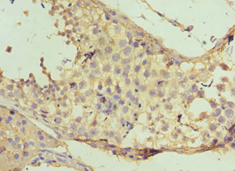 Polyclonal Rabbit anti-Human NAA10 / ARD1A Antibody (aa161-235, IHC, WB)