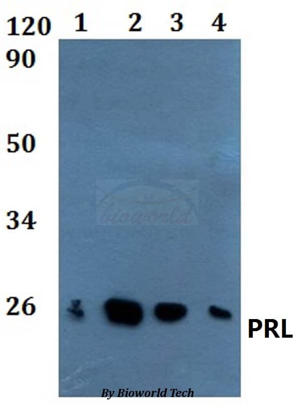 Polyclonal Rabbit anti-Human PRL / Prolactin Antibody (WB)