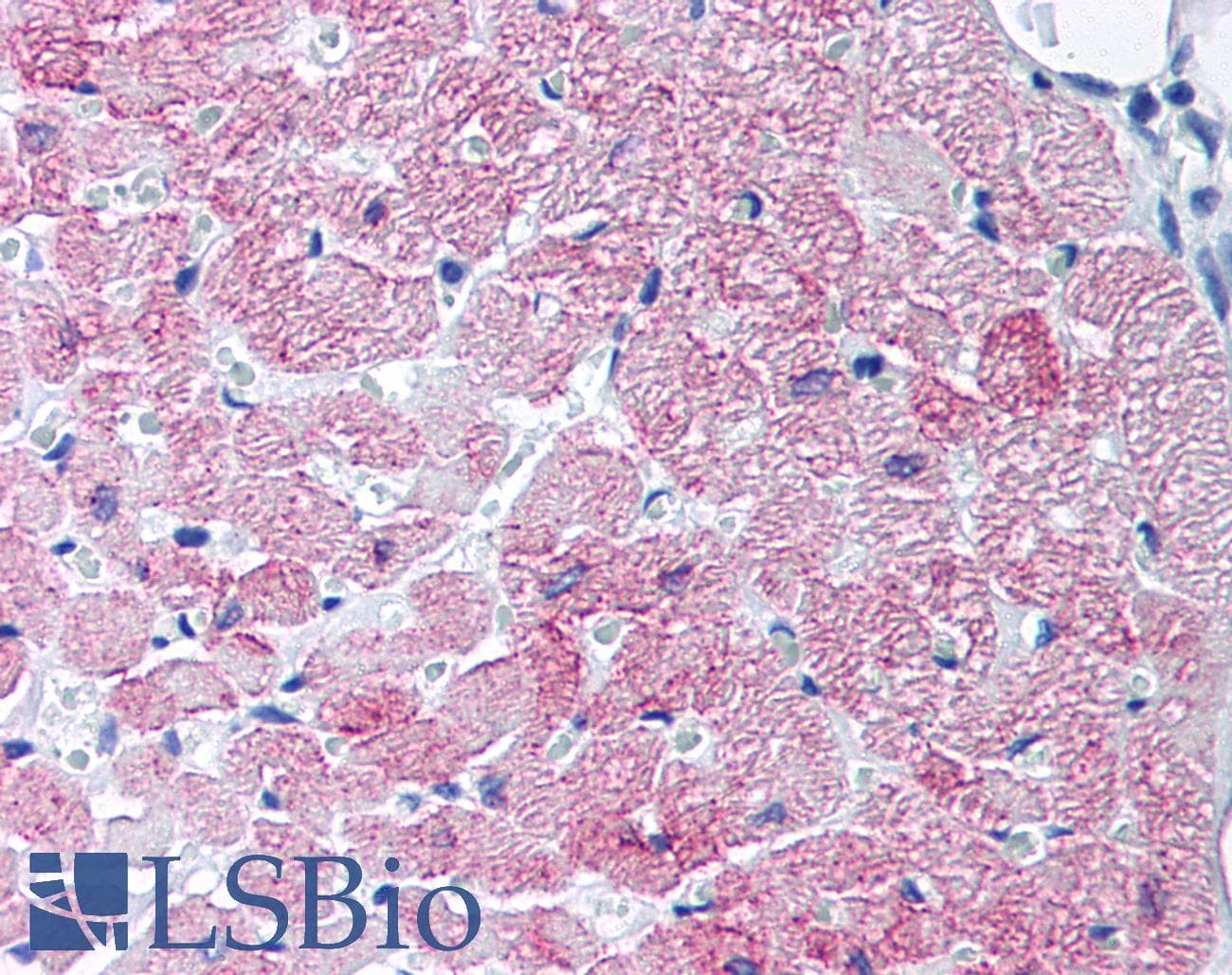IHC-plus™ Polyclonal Rabbit anti-Human SLC2A4 / GLUT-4 Antibody (IHC)
