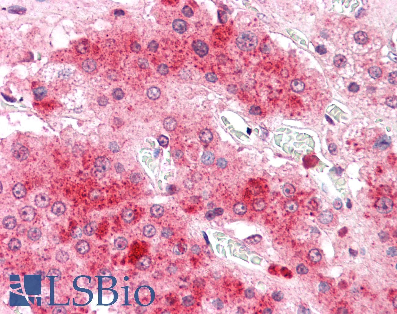 IHC-plus™ COMT Antibody (C-Terminus)