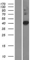 PDSS2 / DLP1 Protein (Over-Expression Lysate Myc-DDK (Flag))