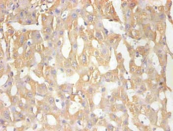 Monoclonal Mouse anti-Human RBP4 Antibody (WB)