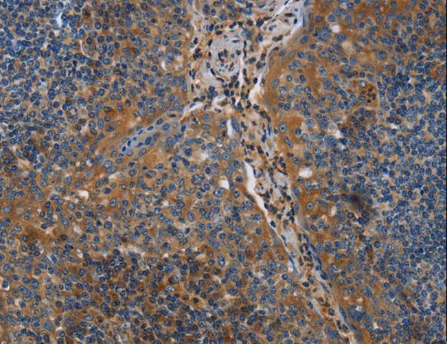 Polyclonal Rabbit anti-Human NRN1 / Neuritin Antibody (IHC)
