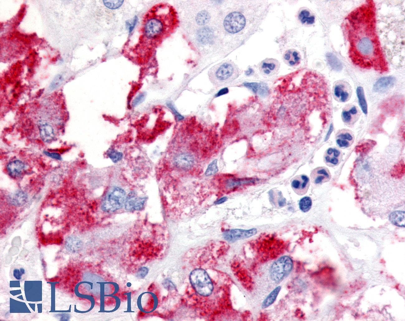 IHC-plus™ BECN1 / Beclin-1 Antibody