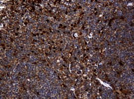 TP / Thymidine Phosphorylase Antibody (clone OTI5B5)