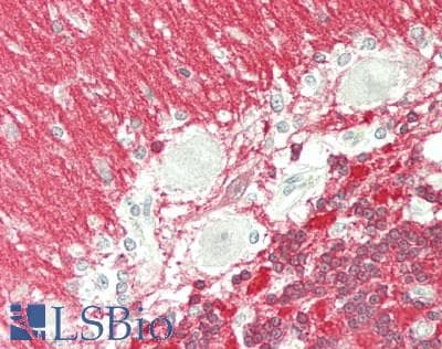 IHC-plus™ Monoclonal Mouse anti-Human VILIP / VSNL1 Antibody (clone 4G1, aa2-191, IHC, WB)