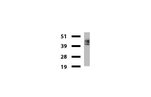 KRT8 / CK8 / Cytokeratin 8 Antibody (aa91-381, clone UMAB1)
