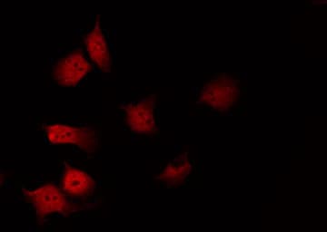 KCNJ11 / Kir6.2 Antibody
