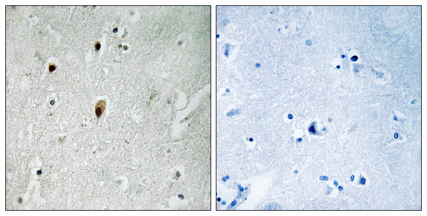 PRKDC / DNA-PKcs Antibody (phospho-Thr2647)