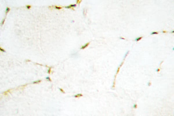 Polyclonal Rabbit anti-Human SMAD1+5+9 Antibody (Gln22, IHC, WB)