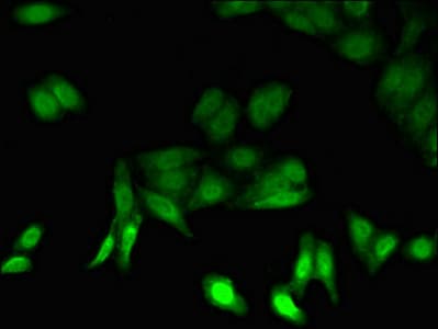 PSMB5 Antibody