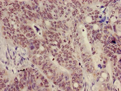 HIST1H3A Antibody