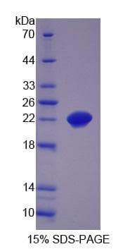 Human ZBED9 / SCAND3 Protein (Recombinant His-S)
