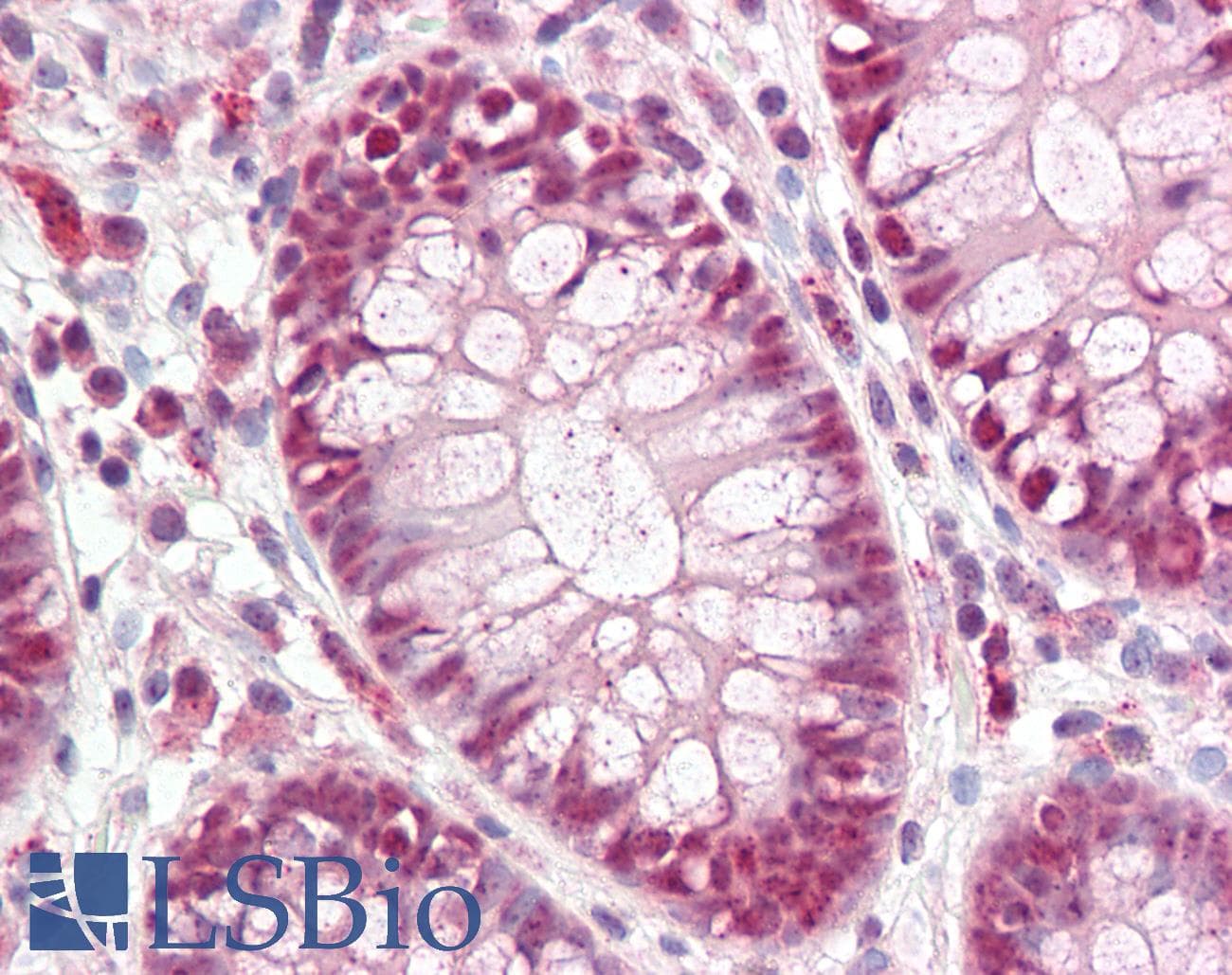 IHC-plus™ Polyclonal Rabbit anti-Human CDX2 Antibody (aa1-60, IHC, WB)