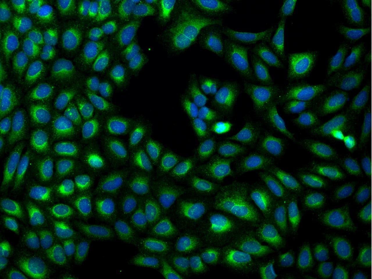 Polyclonal Rabbit anti-Human MXRA7 Antibody (IHC, IF)