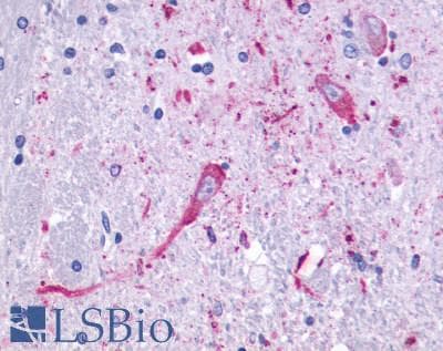 PathPlus™ Polyclonal Rabbit anti-Human HTR4 / 5-HT4 Receptor Antibody (Cytoplasmic Domain, IHC)