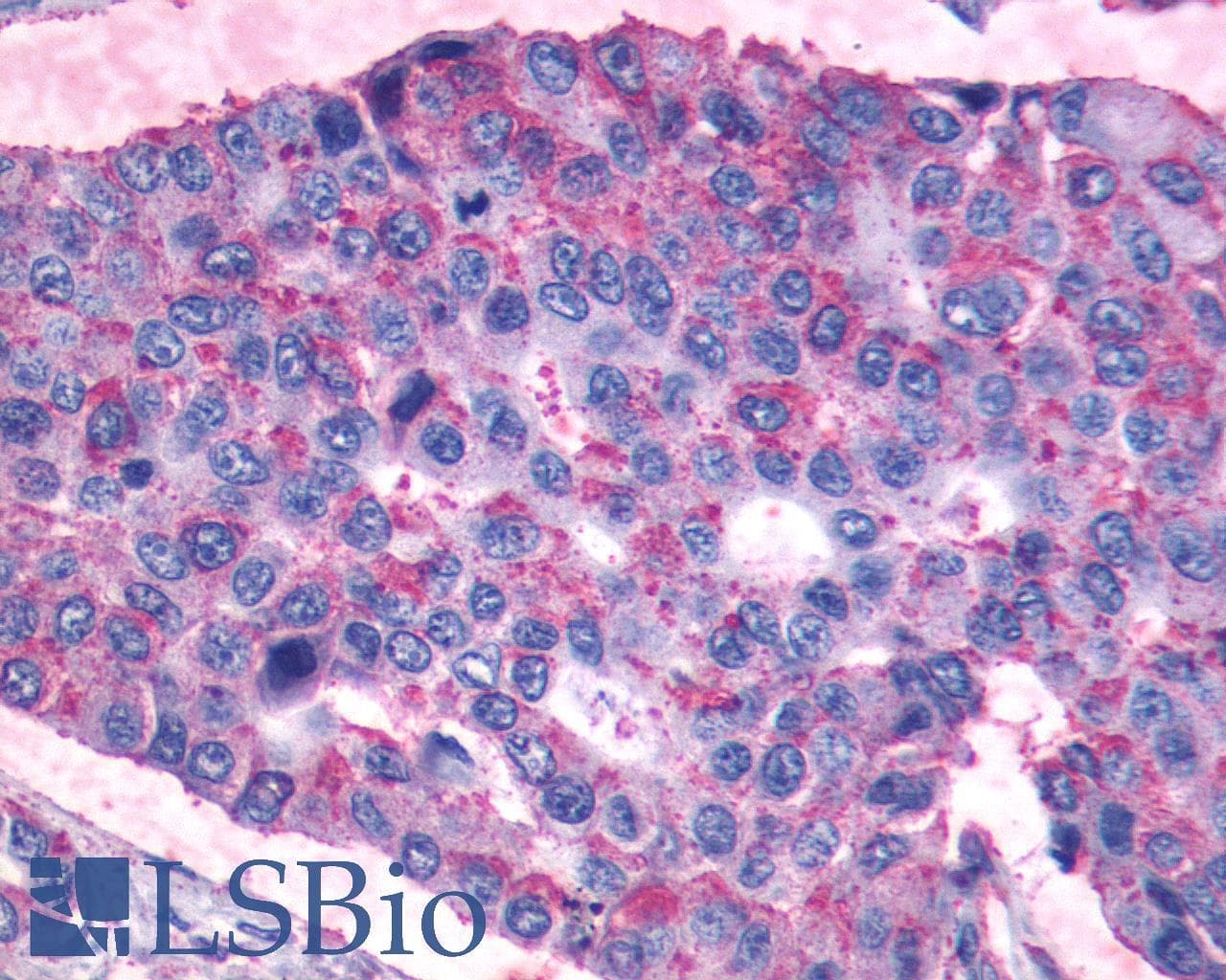 PathPlus™ PTGIR / IP Receptor Antibody (N-Terminus)
