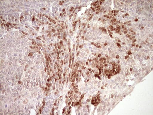 KLF2 Antibody (clone OTI3A10)