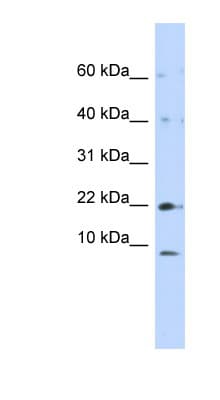 NDUFC2 Antibody (N-Terminus)