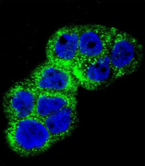 IGF1R / IGF1 Receptor Antibody (aa51-77)