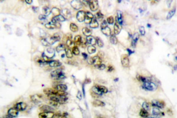 CCNE1 / Cyclin E1 Antibody (Leu389)