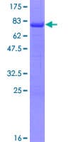 Human RORB / ROR Beta Protein (Recombinant GST)