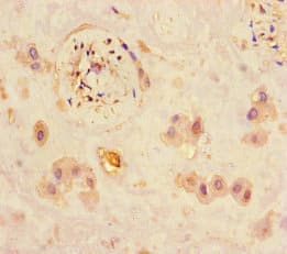 JARID2 / JMJ Antibody