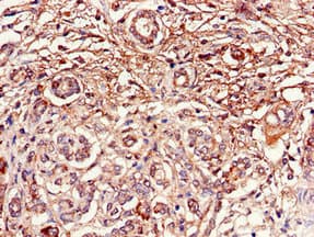 Polyclonal Rabbit anti-Human DUSP19 / SKRP1 Antibody