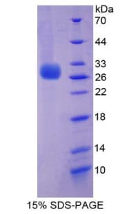 Rat PRF1 / Perforin Protein (Recombinant His-T7)
