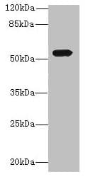 ALS2CR15 / ICA1L Antibody