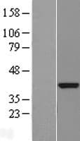 Human DENND1B Protein (Over-Expression Lysate Myc-DDK (Flag))