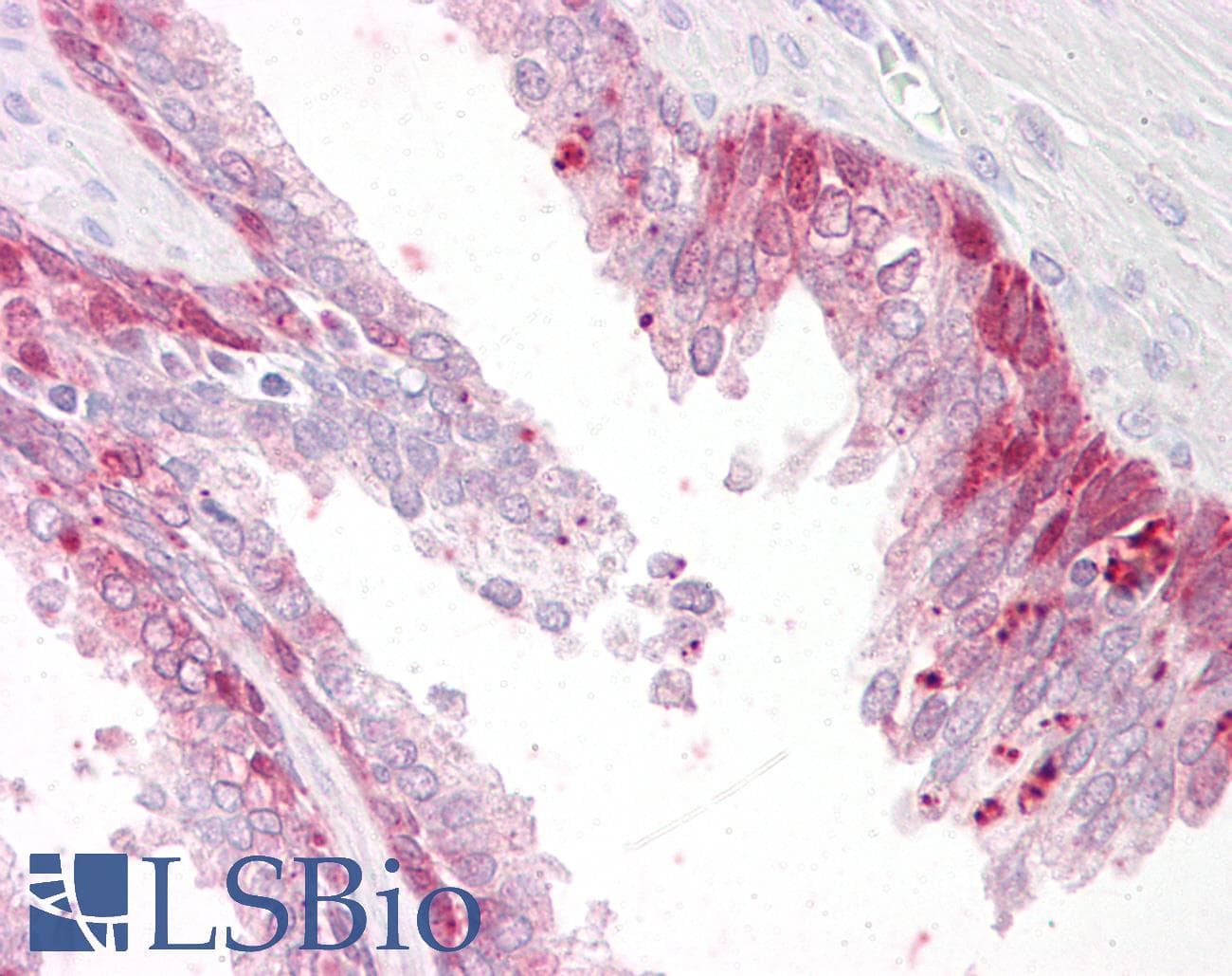 IHC-plus™ Polyclonal Goat anti-Human PHLDA2 / TSSC3 Antibody (aa139-152, IHC)