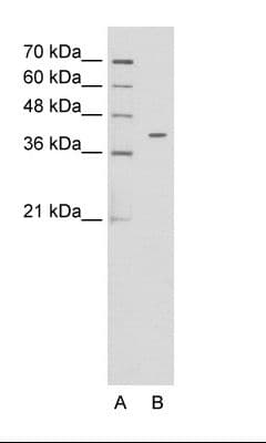 Polyclonal Rabbit anti-Human PSG6 Antibody (aa51-100, WB)