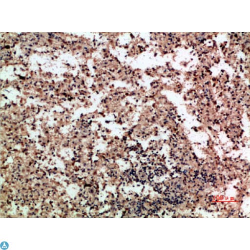 CXCL4 / PF4 Antibody